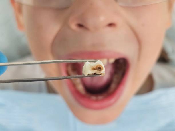 Best Pediatric Emergency Dentist in Coachella, CA